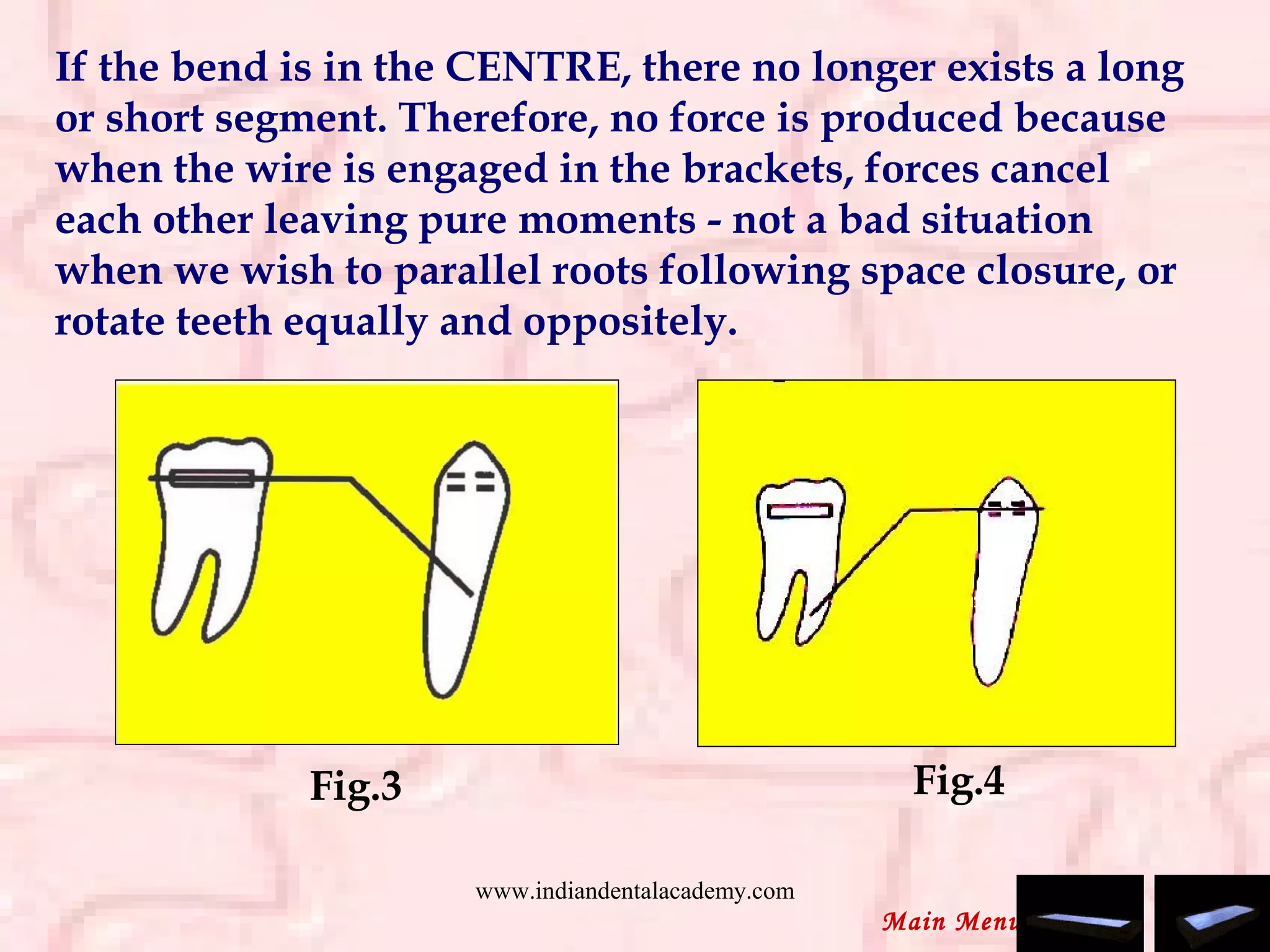 If the bend is in the CENTRE, there no longer exists a long
or short segment. Therefore, no force is produced because
when the wire is engaged in the brackets, forces cancel
each other leaving pure moments - not a bad situation
when we wish to parallel roots following space closure, or
rotate teeth equally and oppositely.
Fig.3 Fig.4
Main Menu
www.indiandentalacademy.com
 