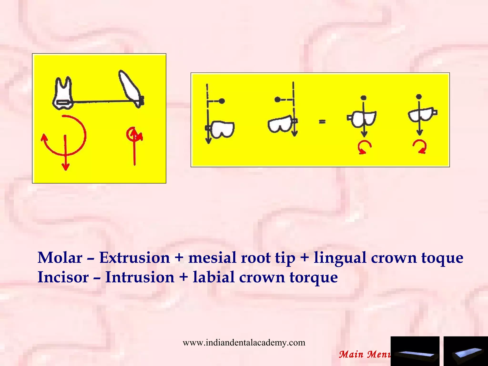 Molar – Extrusion + mesial root tip + lingual crown toque
Incisor – Intrusion + labial crown torque
Main Menu
www.indiandentalacademy.com
 