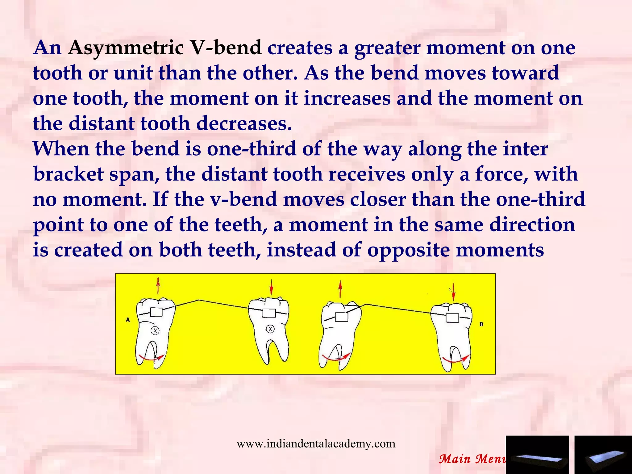 An Asymmetric V-bend creates a greater moment on one
tooth or unit than the other. As the bend moves toward
one tooth, the moment on it increases and the moment on
the distant tooth decreases.
When the bend is one-third of the way along the inter
bracket span, the distant tooth receives only a force, with
no moment. If the v-bend moves closer than the one-third
point to one of the teeth, a moment in the same direction
is created on both teeth, instead of opposite moments
Main Menu
www.indiandentalacademy.com
 