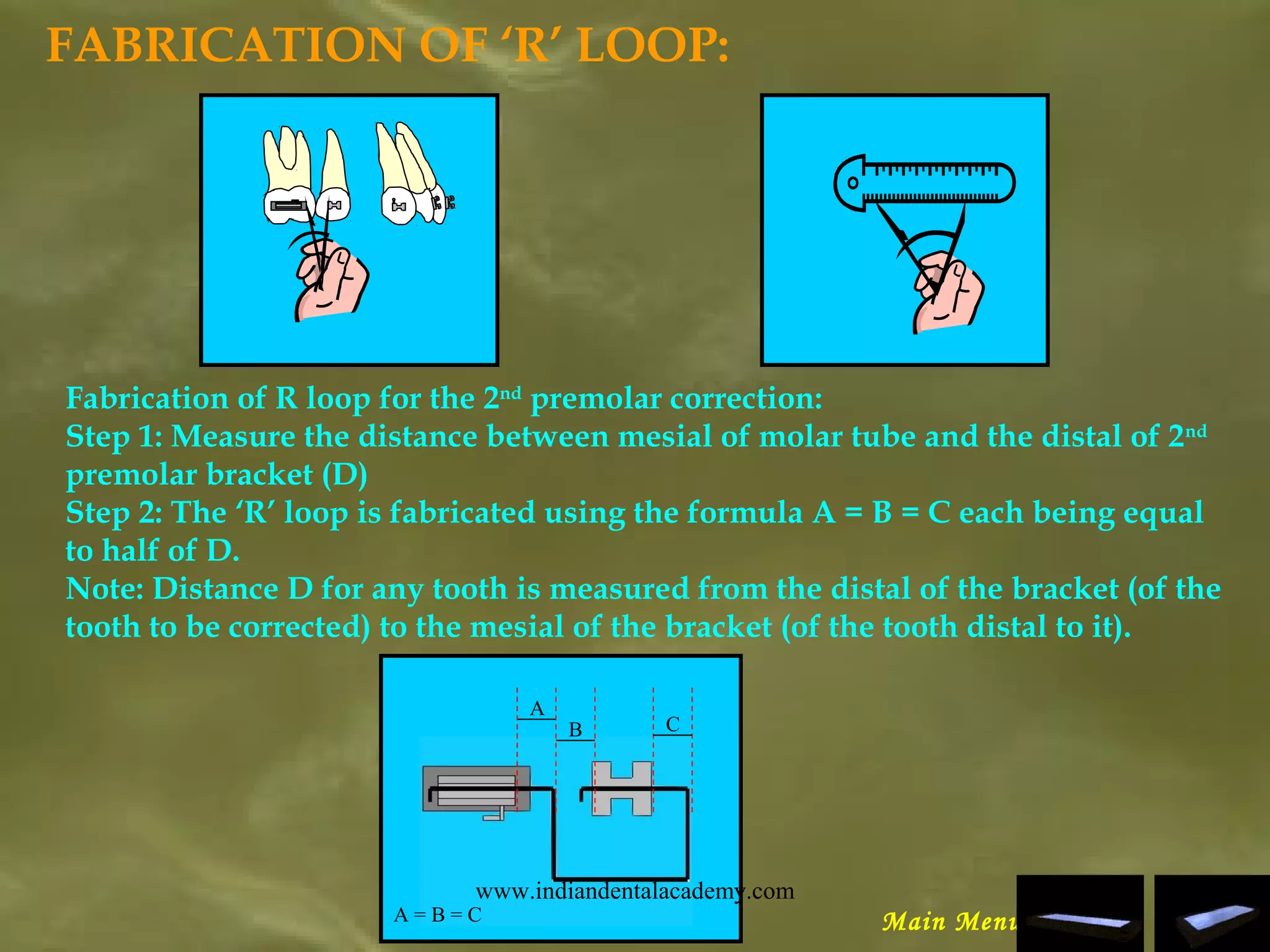 FABRICATION OF ‘R’ LOOP:
Fabrication of R loop for the 2nd
premolar correction:
Step 1: Measure the distance between mesial of molar tube and the distal of 2nd
premolar bracket (D)
Step 2: The ‘R’ loop is fabricated using the formula A = B = C each being equal
to half of D.
Note: Distance D for any tooth is measured from the distal of the bracket (of the
tooth to be corrected) to the mesial of the bracket (of the tooth distal to it).
A
B C
A = B = C Main Menu
www.indiandentalacademy.com
 