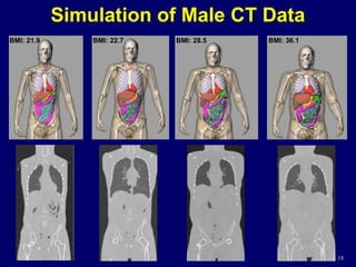 18
Simulation of Male CT Data
BMI: 21.9 BMI: 22.7 BMI: 28.5 BMI: 36.1
18
 