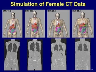 19
Simulation of Female CT Data
BMI: 18.2 BMI: 22.3 BMI: 28.6 BMI: 35.5
19
 