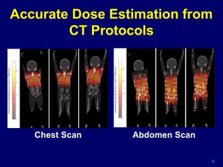 Accurate Dose Estimation from
CT Protocols
21
Chest Scan Abdomen Scan
 