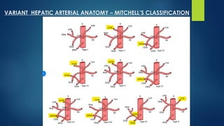 Mitchell Classification Comprehensive Overview of Liver Segmental and Vascular Anatomy for ...