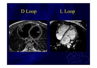 Segmental approach and evaluation of cardiac morphology | PDF