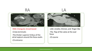 RA LA
-RAA: triangular, broad-based
-Crista terminalis
-The thicker superior limbus of the
atrial septum around the fossa ...
