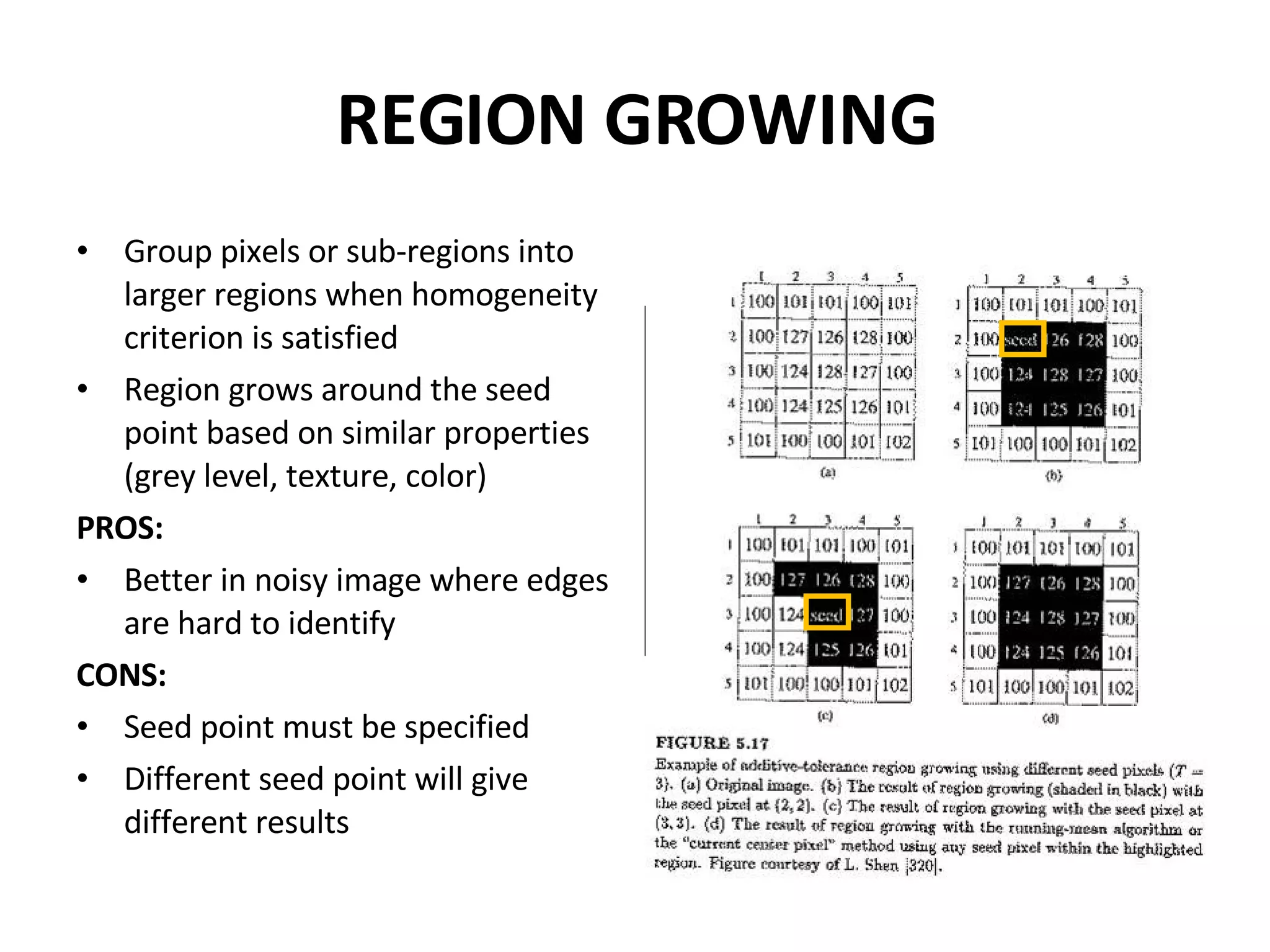 REGION GROWING Group pixels or sub-regions into larger regions when homogeneity criterion is satisfied  Region grows around the seed point based on similar properties (grey level, texture, color) PROS: Better in noisy image where edges are hard to identify CONS: Seed point must be specified Different seed point will give different results PIXEL AGGREGATION: Homogeneity criteria: The difference between 2 pixel values is less than or equal to 5 Horizontal, vertical, diagonal 10 10 10 10 10 10 10 10 10 10 69 70 10 10 59 10 60 64 59 56 60 10 59 10 60 70 10 62 10 60 59 65 67 10 65 10 10 10 10 10 10 10 10 10 10 10 10 10 10 