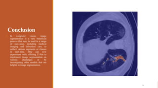 Covid-19 Segmentation of Lung CT images.pptx