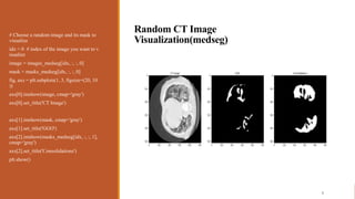 Covid-19 Segmentation of Lung CT images.pptx