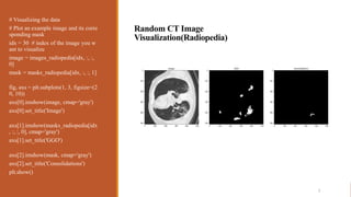 Covid-19 Segmentation of Lung CT images.pptx