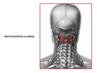 RECTO MAYOR DE LA CABEZA
 