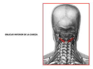 OBLICUO INFERIOR DE LA CABEZA
 