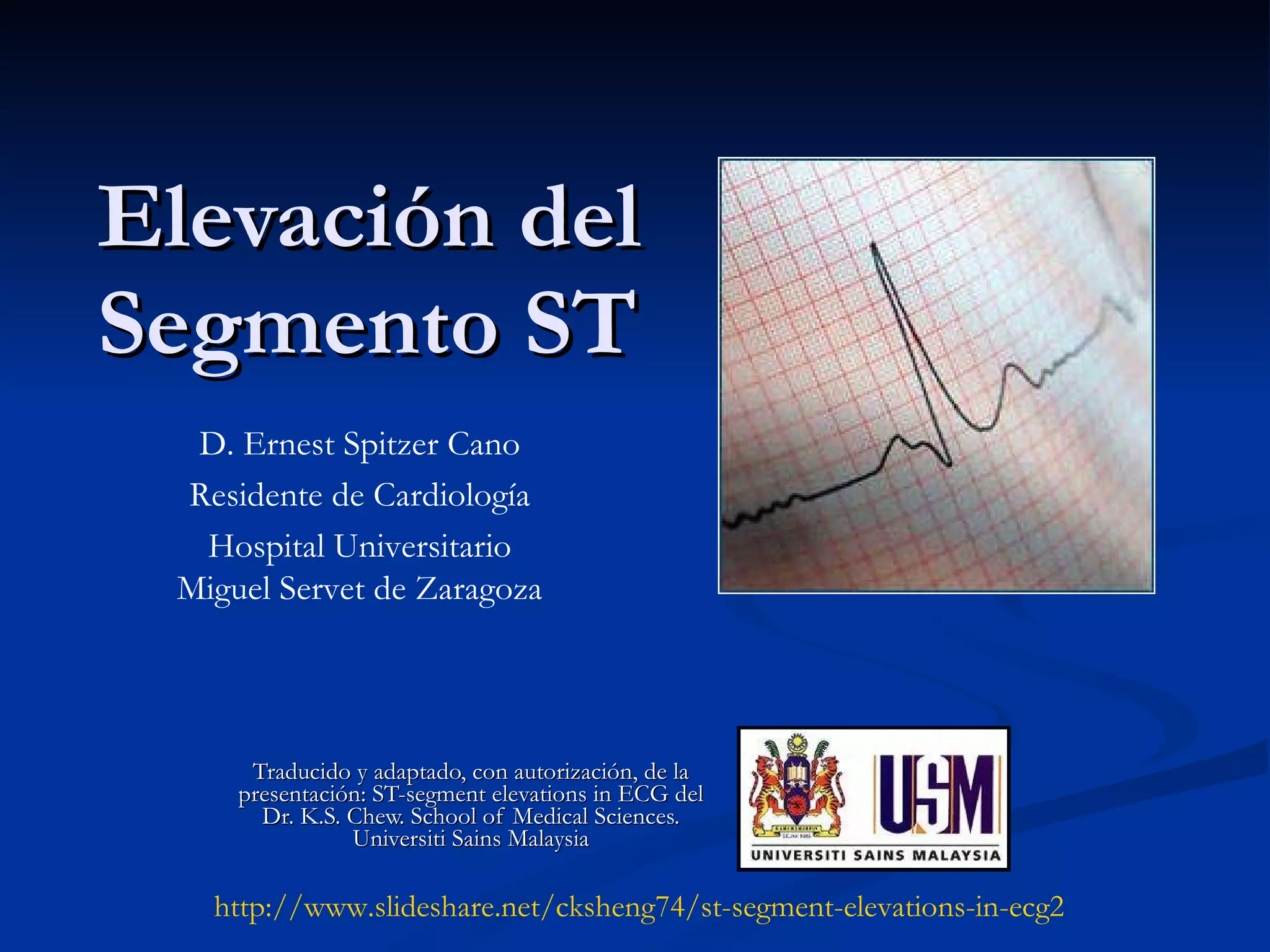Elevación del Segmento ST Traducido y adaptado, con autorización, de la presentación: ST-segment elevations in ECG del Dr. K.S. Chew. School of Medical Sciences. Universiti Sains Malaysia D. Ernest Spitzer Cano Residente de Cardiología Hospital Universitario Miguel Servet de Zaragoza http :// www.slideshare.net /cksheng74/ st - segment - elevations -in-ecg2 