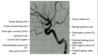 Ica Path Segments of internal carotid artery | PPTX
