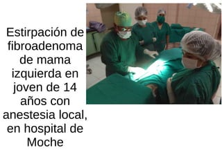 Estirpación de
fibroadenoma
de mama
izquierda en
joven de 14
años con
anestesia local,
en hospital de
Moche
 