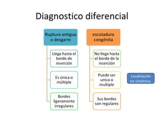 Diagnostico diferencial
Localización
no simétrica
 