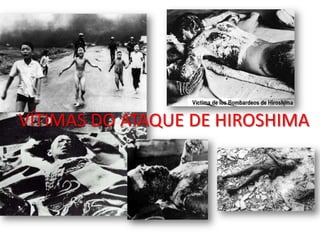 VÍTIMAS DO ATAQUE DE HIROSHIMA
 