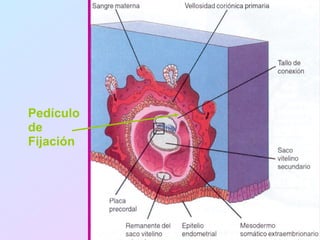 Pedículo
de
Fijación
 