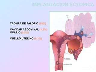IMPLANTACION ECTOPICA.


TROMPA DE FALOPIO (95%)

CAVIDAD ABDOMINAL (1,3%)
OVARIO (0.5%)

CUELLO UTERINO (0.1%)
 