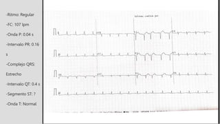 -Ritmo: Regular
-FC: 107 lpm
-Onda P: 0.04 s
-Intervalo PR: 0.16
s
-Complejo QRS:
Estrecho
-Intervalo QT: 0.4 s
-Segmento ST: ?
-Onda T: Normal
 