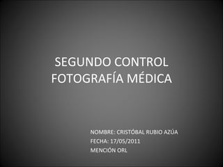SEGUNDO CONTROL FOTOGRAFÍA MÉDICA NOMBRE: CRISTÓBAL RUBIO AZÚA  FECHA: 17/05/2011 MENCIÓN ORL 
