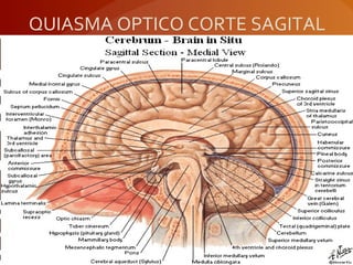 QUIASMA OPTICO CORTE SAGITAL
 