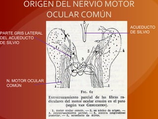 ORIGEN DEL NERVIO MOTOR
OCULAR COMÚN
PARTE GRIS LATERAL
DEL ACUEDUCTO
DE SILVIO
N. MOTOR OCULAR
COMÚN
ACUEDUCTO
DE SILVIO
 