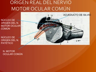 ORIGEN REAL DEL NERVIO
MOTOR OCULAR COMÚN
NÚCLEO DE
ORIGEN DEL N.
MOTOR OCULAR
COMÚN
NÚCLEO DE
ORIGEN DEL N.
PATÉTICO
N. MOTOR
OCULAR COMÚN
ACUEDUCTO DE SILVIO
 