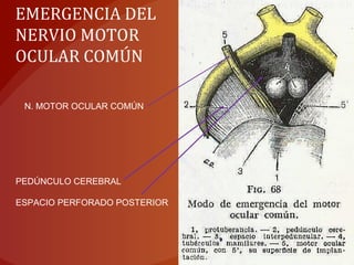 EMERGENCIA DEL
NERVIO MOTOR
OCULAR COMÚN
PEDÚNCULO CEREBRAL
ESPACIO PERFORADO POSTERIOR
N. MOTOR OCULAR COMÚN
 