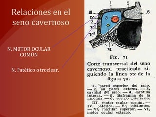 Relaciones en el
seno cavernoso
N. MOTOR OCULAR
COMÚN
N. Patético o troclear.
 