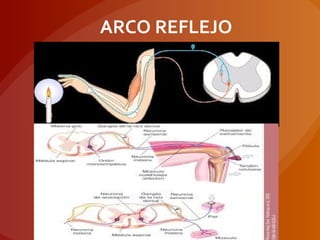 ARCO REFLEJO
 
