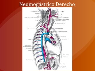 Neumogástrico Derecho
 