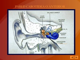 PARED CAROTIDEA O ANTERIOR
 