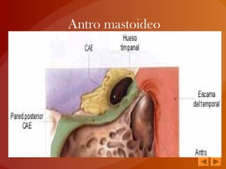 Antro mastoideo
 
