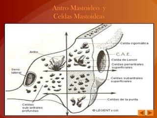 Antro Mastoideo y
Celdas Mastoideas
 