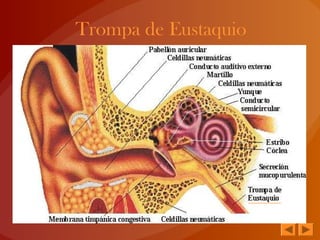 Trompa de Eustaquio
 