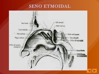 SENO ETMOIDAL
 