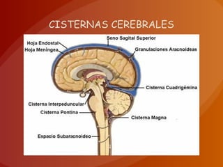 CISTERNAS CEREBRALES
 