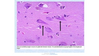 Document shared on www.docsity.com
Downloaded by: luiggi-solano (luiggi_solano@hotmail.es)
 