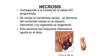 NECROSIS
Corresponde a la muerte de la célula NO
programada.
Se rompe la membrana celular , se derrama
del contenido celular en el espacio
intersticial. Los organelos se degeneran.
Esto provoca una respuesta inflamatoria
aguda en el área.
•
•
•
 