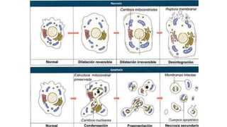 alteraciones intracelulares