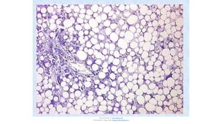 Document shared on www.docsity.com
Downloaded by: luiggi-solano (luiggi_solano@hotmail.es)
 