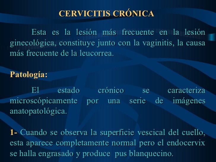 orinar engrasado orinar engrasado