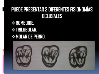 PUEDE PRESENTAR 3 DIFERENTES FISIONOMÍAS OCLUSALES 
ROMBOIDE. 
TRILOBULAR. 
MOLAR DE PERRO.  