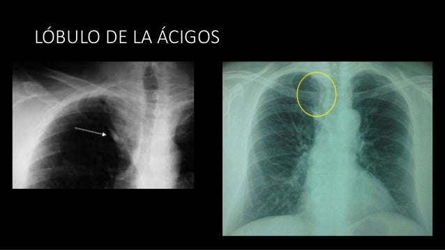 Imagenologia tórax y abdomen