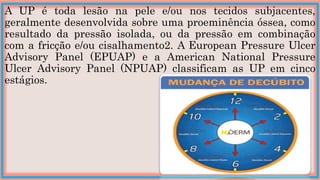 A UP é toda lesão na pele e/ou nos tecidos subjacentes,
geralmente desenvolvida sobre uma proeminência óssea, como
resultado da pressão isolada, ou da pressão em combinação
com a fricção e/ou cisalhamento2. A European Pressure Ulcer
Advisory Panel (EPUAP) e a American National Pressure
Ulcer Advisory Panel (NPUAP) classificam as UP em cinco
estágios.
 