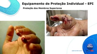 Proteção dos Membros Superiores
Equipamento de Proteção Individual - EPI
 