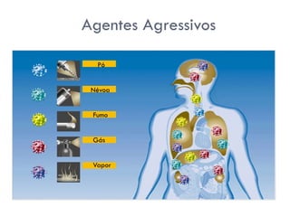 Agentes Agressivos
Pó
Névoa
Fumo
Gás
Vapor
 