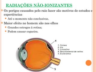 RADIAÇÕES NÃO-IONIZANTES
 Os perigos causados pelo raio laser são motivos de estudos e
experiências
 Até o momento não conclusivas.
 Maior efeito no homem são nos olhos
 Grandes estragos à retina;
 Podem causar cegueira.
 