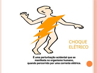É uma perturbação acidental que se
manifesta no organismo humano,
quando percorrido por uma corrente elétrica.
CHOQUE
ELÉTRICO
 